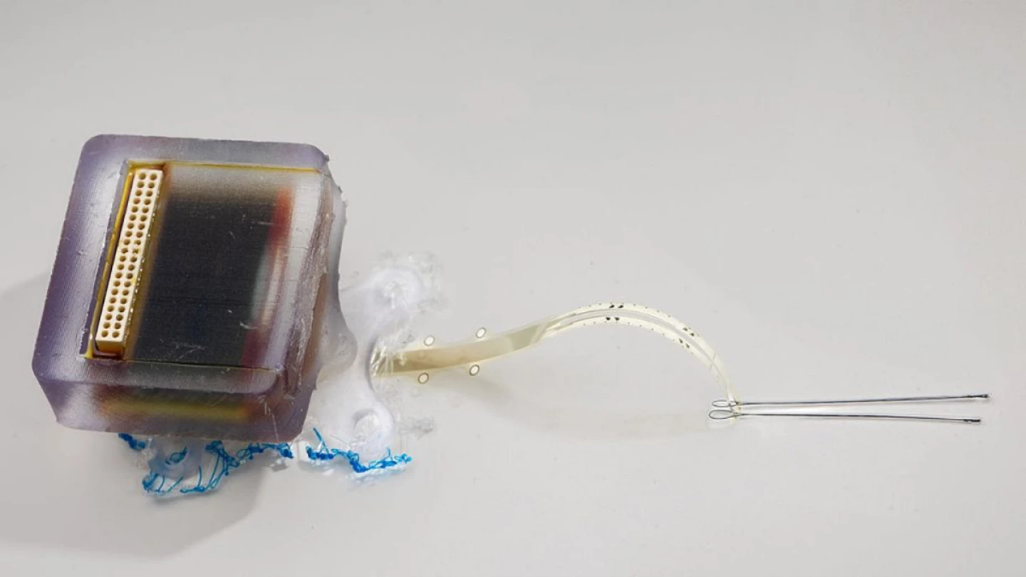 Биосовместимый имплантат оснащен крошечными электродами для подачи контролируемого электрического импульса непосредственно к месту повреждения спинного мозга.