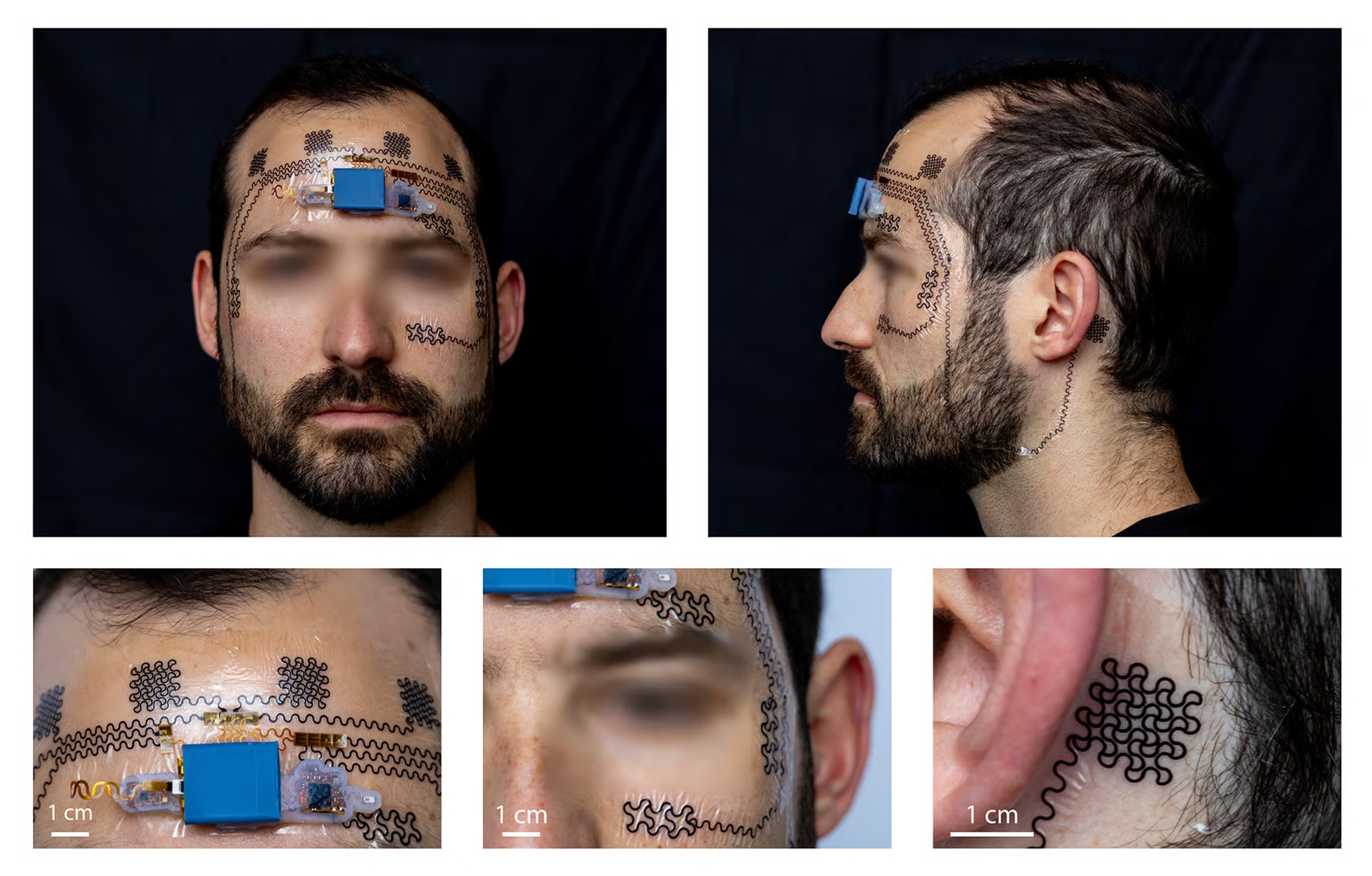 Вот электронная татуировка, показанная со всех сторон.