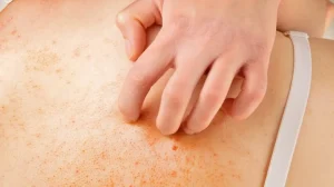 Это приложение для смартфона способно диагностировать кожные заболевания