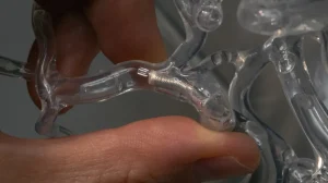 Прорыв в медицине: новый инструмент увеличивает успех удаления тромбов с 50% до 90%