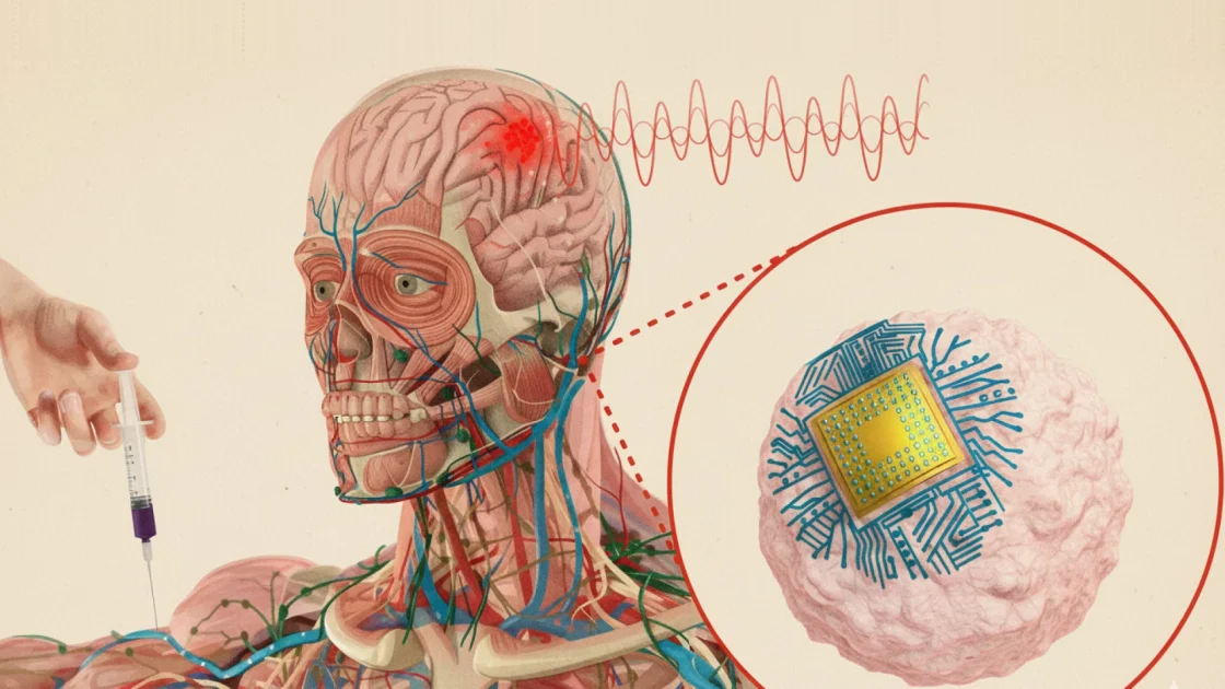 Создан чип который может лечить болезни без хирургического вмешательства