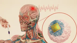 Создан чип который может лечить болезни без хирургического вмешательства